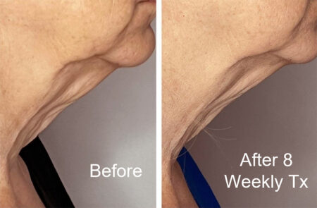 Venus Legacy Neck B&a