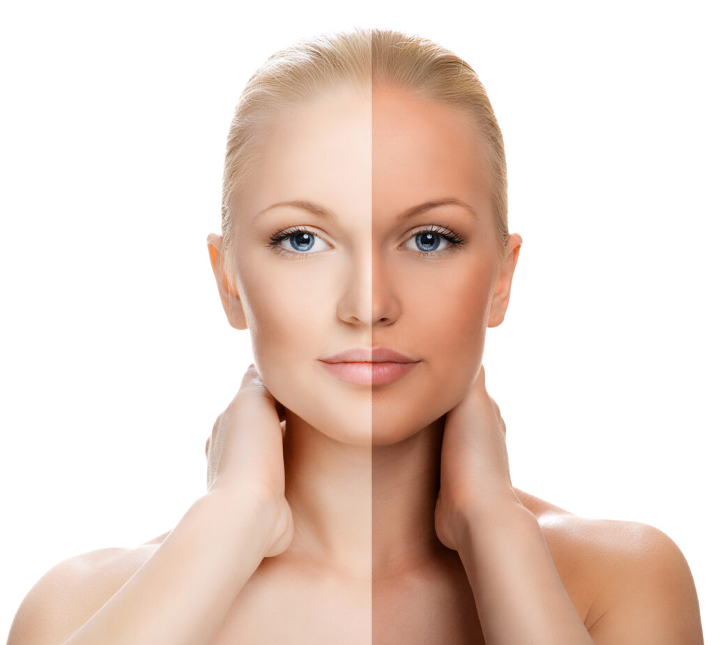 Tan Before And After