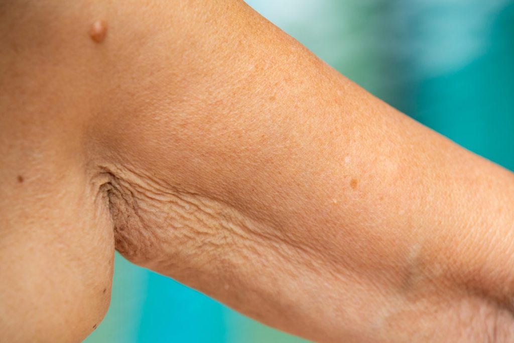 Closeup view of skin showing texture and minor blemishes for dermatological assessment or medical inspection purposes.